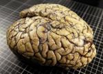 Las grandes incgnitas del cerebro humano