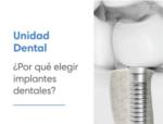 Per qu escollir implantes dentals?